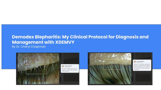 Demodex Blepharitis: My Clinical Protocol for Diagnosis and Management with XDEMVY