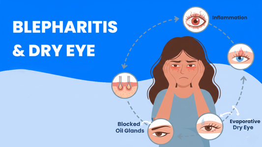 Blepharitis vs Dry Eye: Why Eyelid Hygiene Treats Both