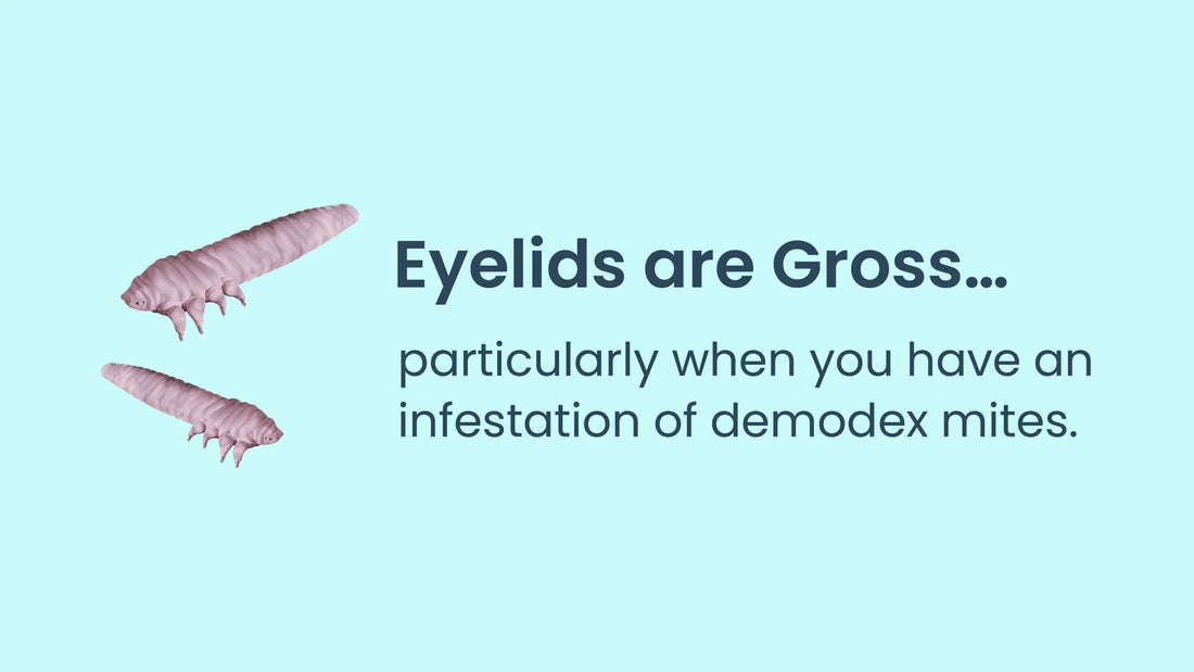 Eyelids Are Gross…Especially with Demodex Mites Hiding Within Them