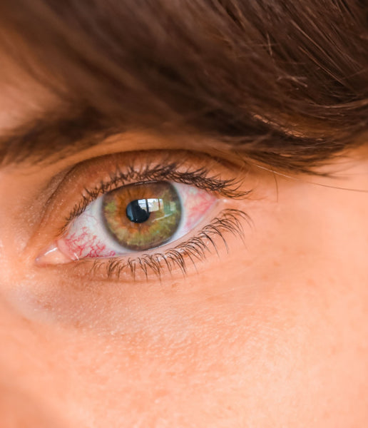 redeyes.jpg